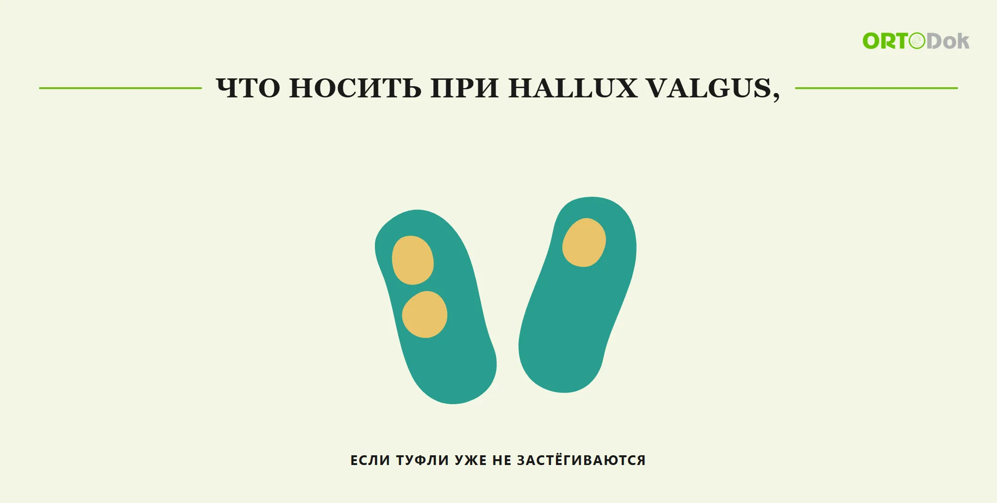 Что носить при hallux valgus, если туфли уже не застёгиваются