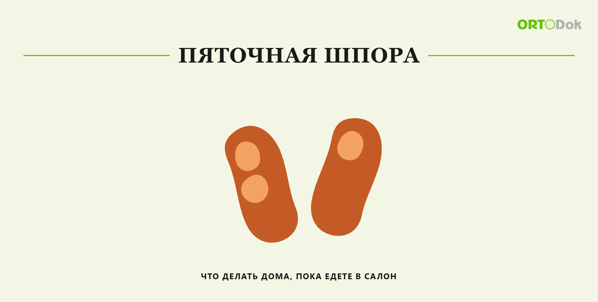 Пяточная шпора: что делать дома, пока едете в салон