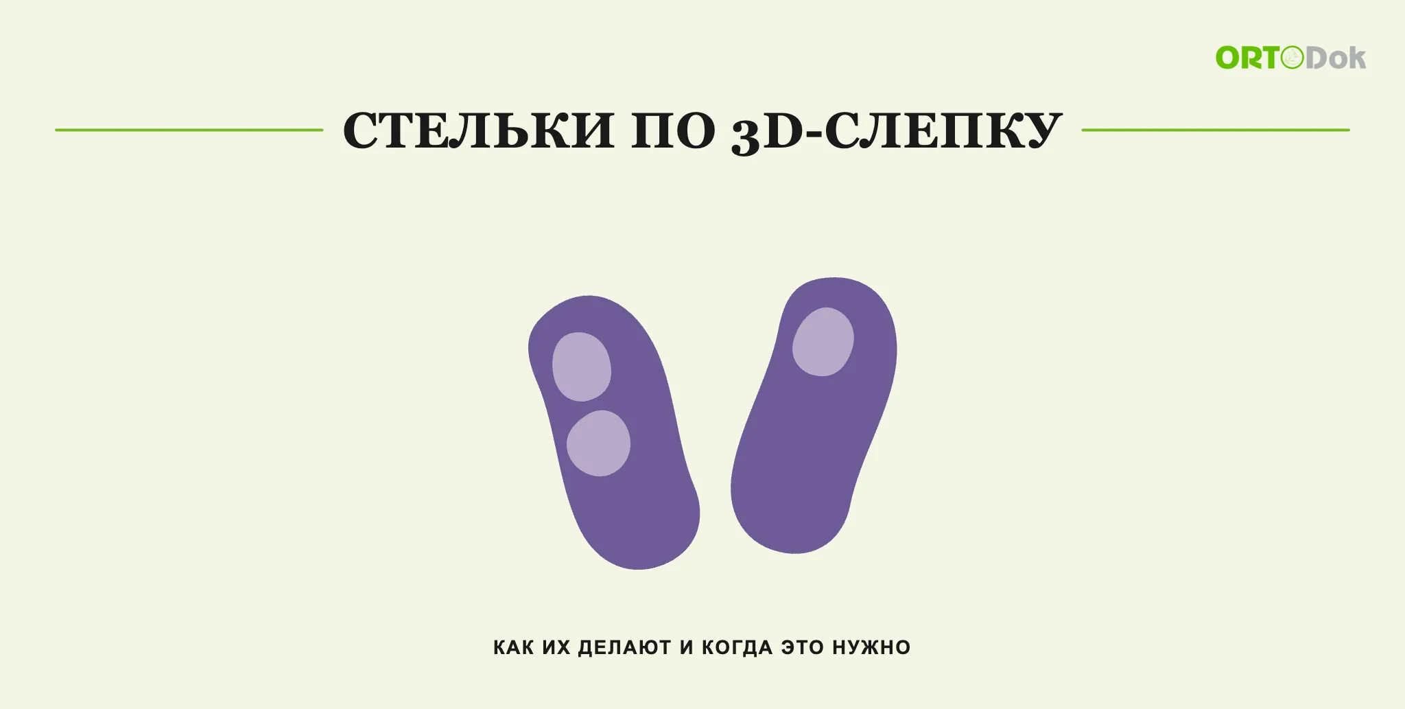Стельки по 3D-слепку: как их делают и когда это нужно