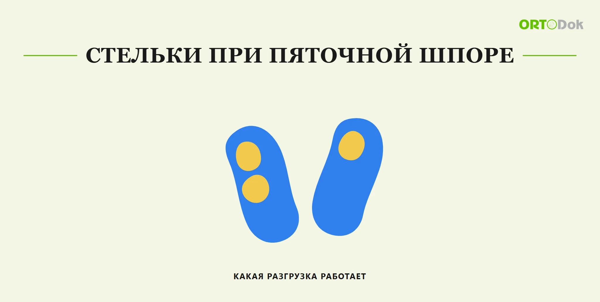 Стельки при пяточной шпоре: какая разгрузка работает